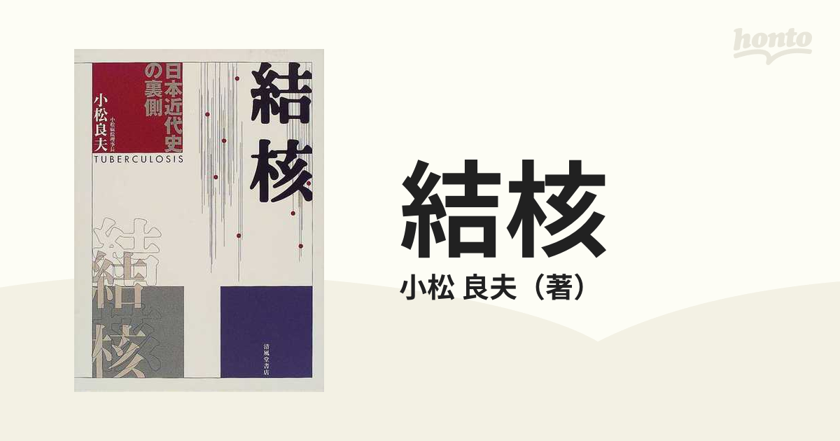 結核 日本近代史の裏側