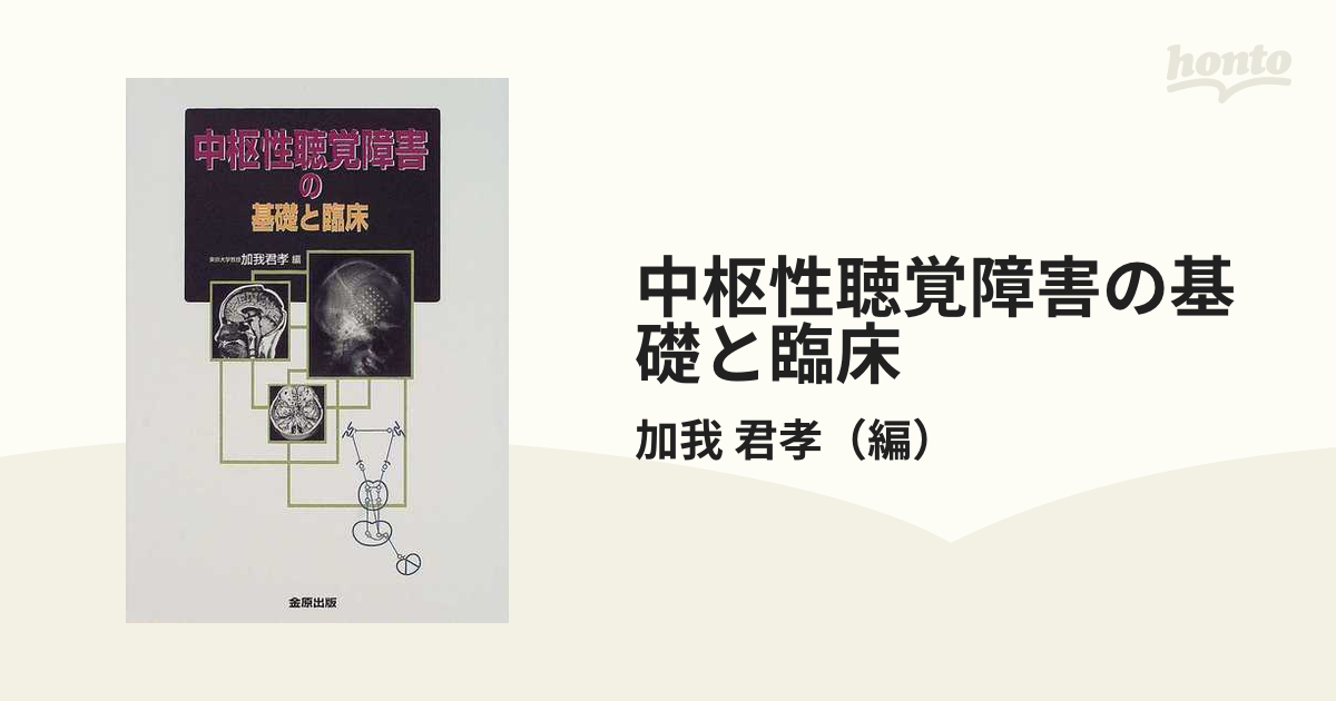 中枢性聴覚障害の基礎と臨床