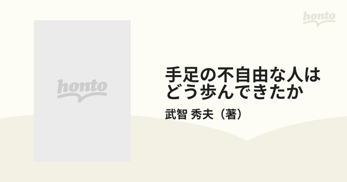 手足の不自由な人はどう歩んできたか 人権思想の変遷と義肢・装具の進歩