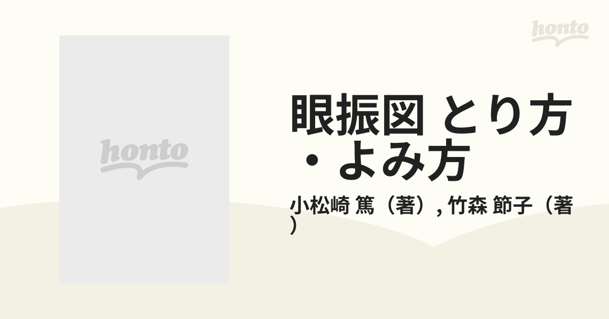 眼振図 とり方・よみ方 2022年春夏再販！ - transport.gov.pg