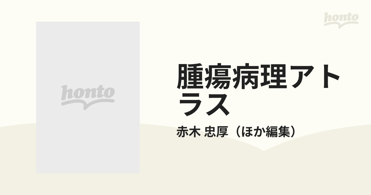 腫瘍病理アトラス 境界病変と鑑別診断の通販/赤木 忠厚 - 紙の本 ...