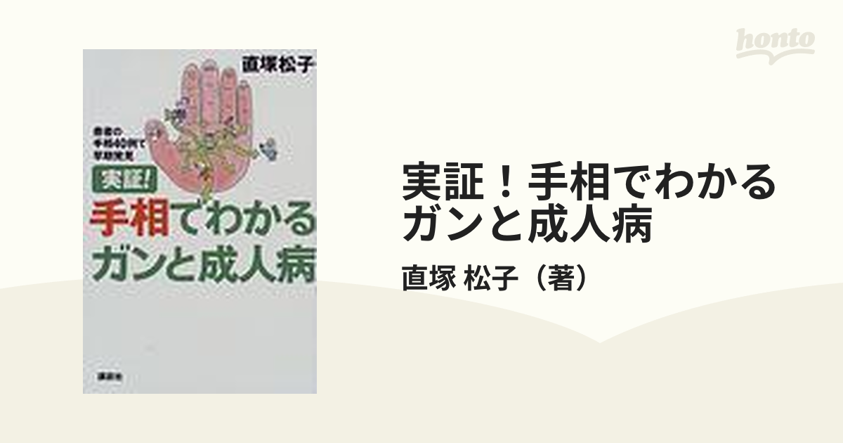 中古】驚異の手相術 病気・ガン・突然死は予知できる！！ /池田書店/直塚松子 - 本