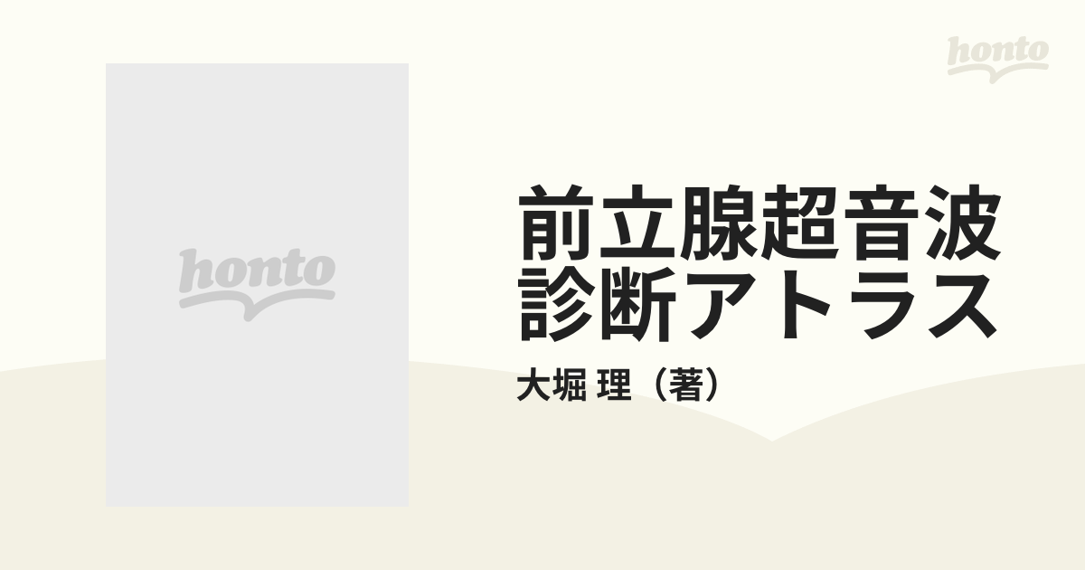 前立腺超音波診断アトラス 経直腸的前立腺超音波を中心にの通販