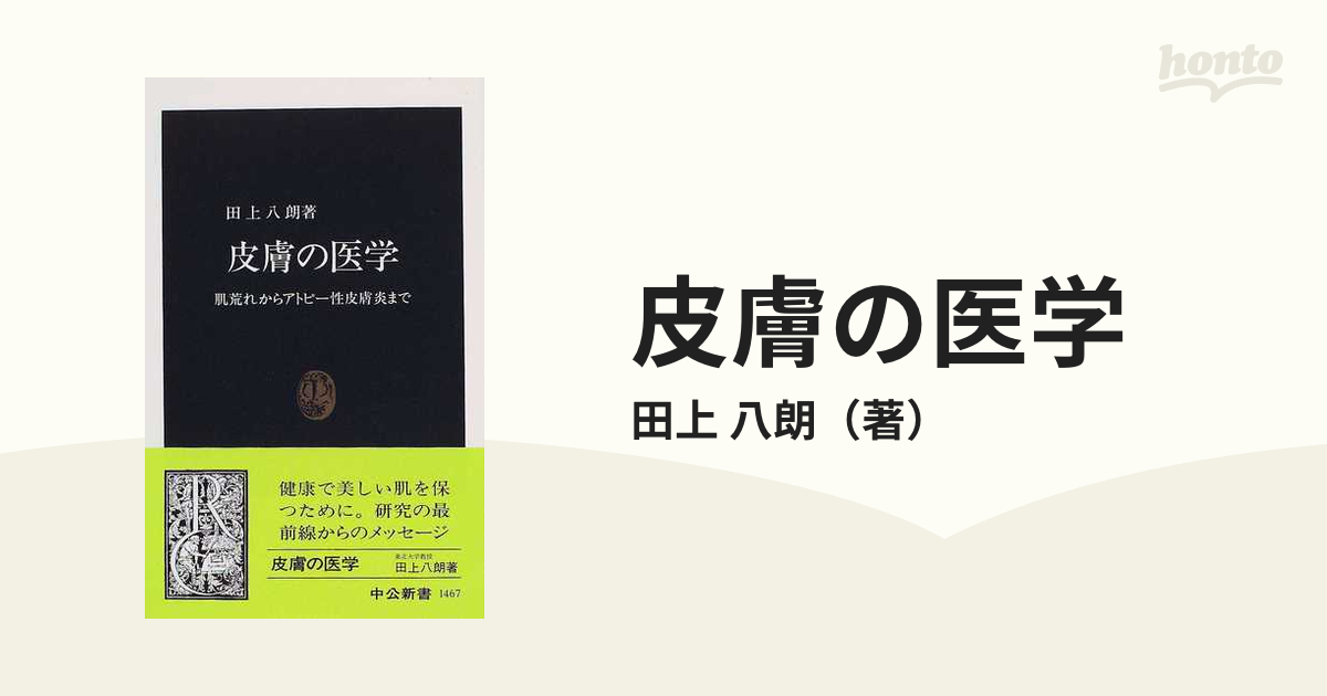 皮膚の医学 肌荒れからアトピー性皮膚炎まで