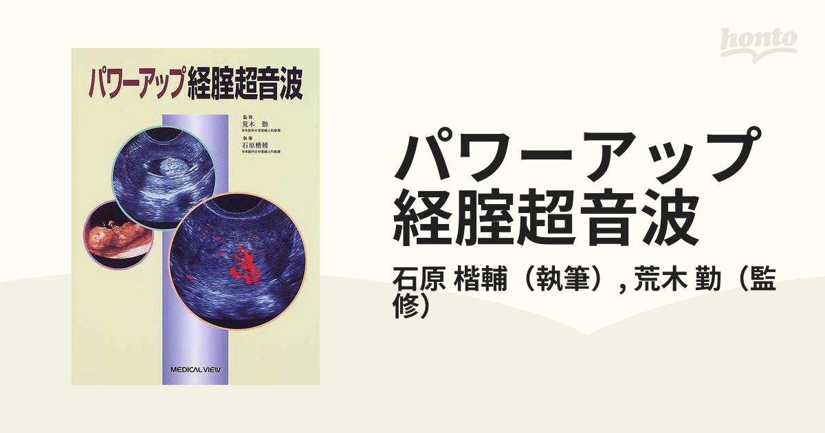 経腟エコーの基本と読み方/メジカルビュー社/石原楷輔 - 健康/医学