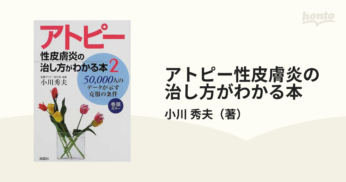 アトピー性皮膚炎の治し方がわかる本 ２/翔雲社（渋谷区）/小川秀夫