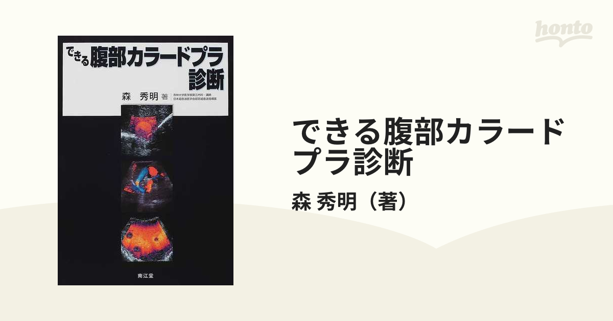 できる腹部カラードプラ診断の通販/森 秀明 - 紙の本：honto本の通販ストア