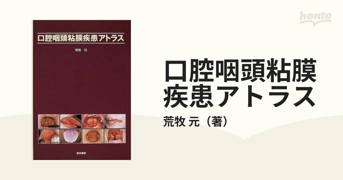 口腔咽頭粘膜疾患アトラスの通販/荒牧 元 - 紙の本：honto本の通販ストア