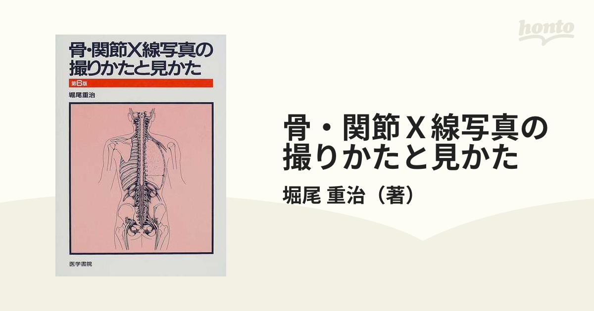 重治　骨・関節Ｘ線写真の撮りかたと見かた　第６版の通販/堀尾　紙の本：honto本の通販ストア