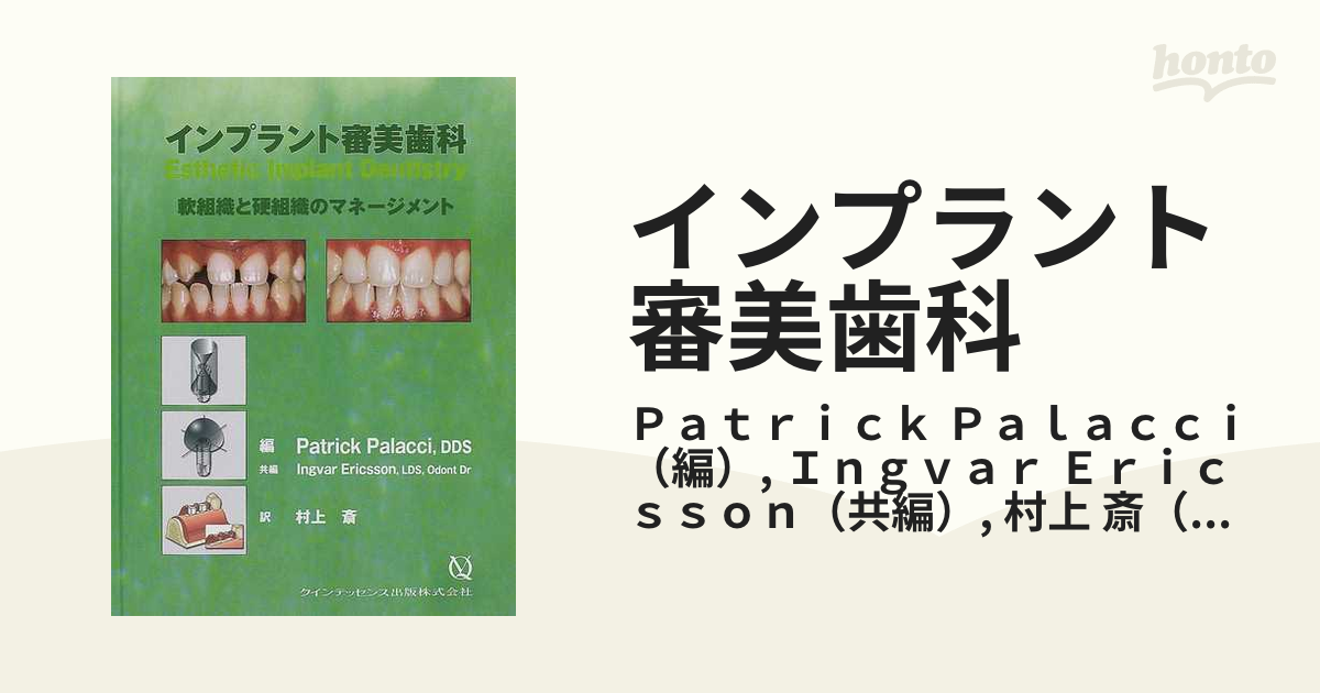 インプラント審美歯科 軟組織と硬組織のマネージメントの通販