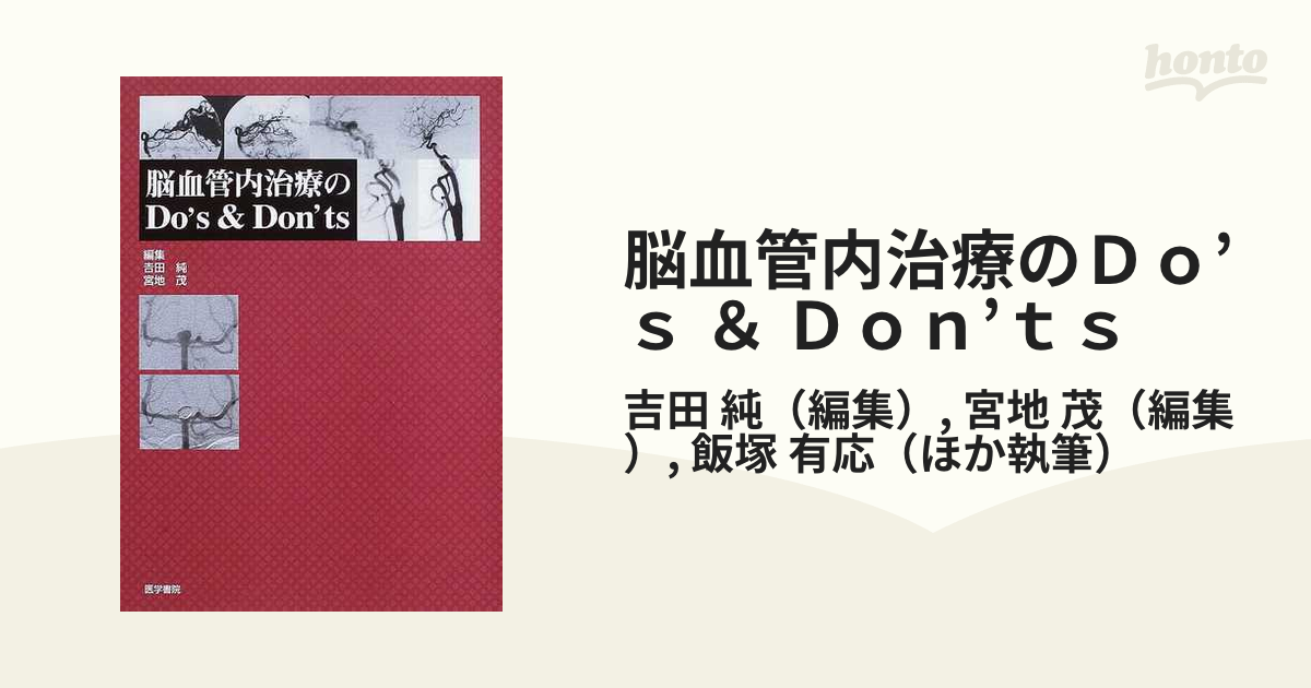 脳血管内治療のＤｏ’ｓ ＆ Ｄｏｎ’ｔｓ