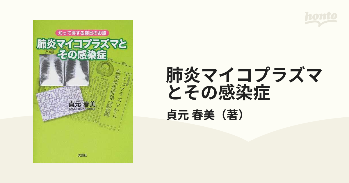 肺炎マイコプラズマとその感染症 知って得する肺炎のお話