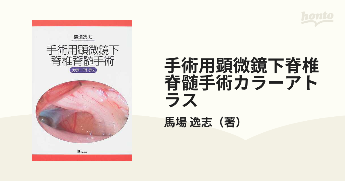 逸志　手術用顕微鏡下脊椎脊髄手術カラーアトラスの通販/馬場　紙の本：honto本の通販ストア