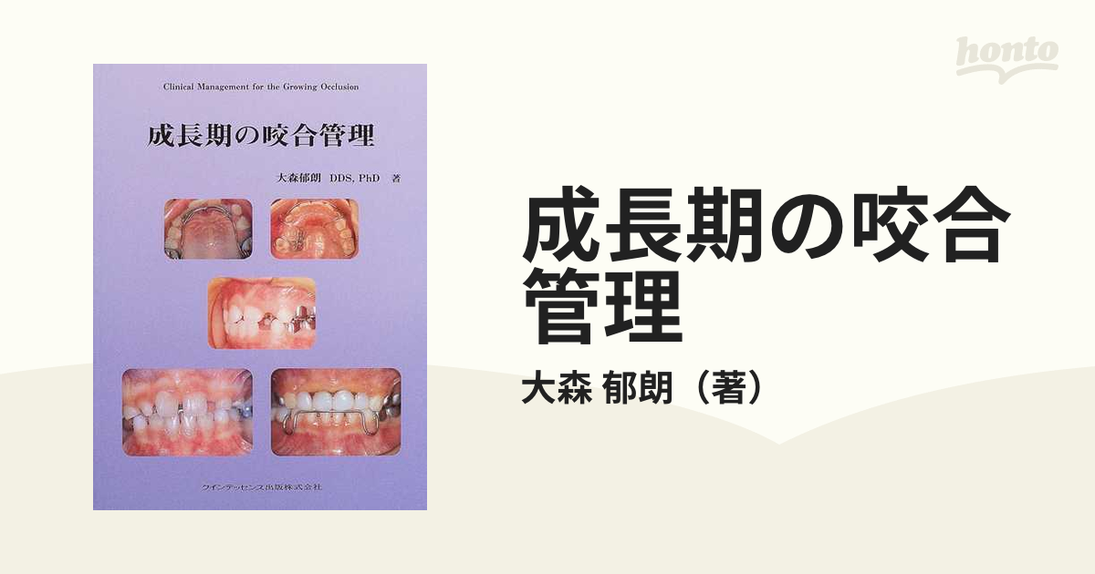 品質一番の 成長期の咬合管理 大型本 – 2003/5/1 健康/医学 