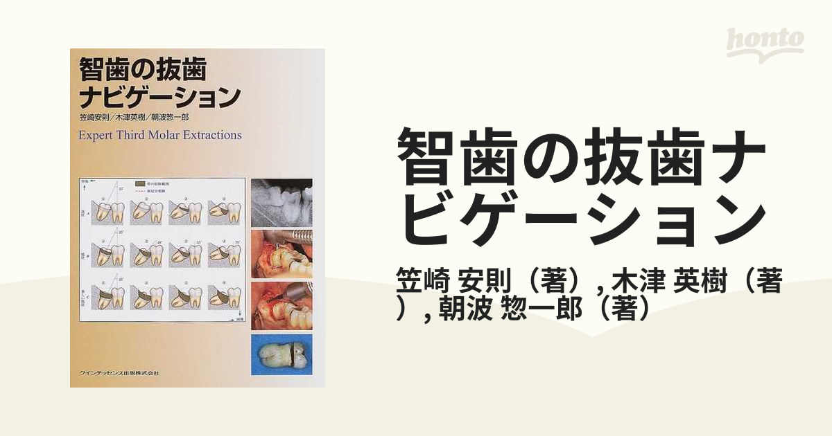 絶版】【裁断済】智歯の抜歯ナビゲーション
