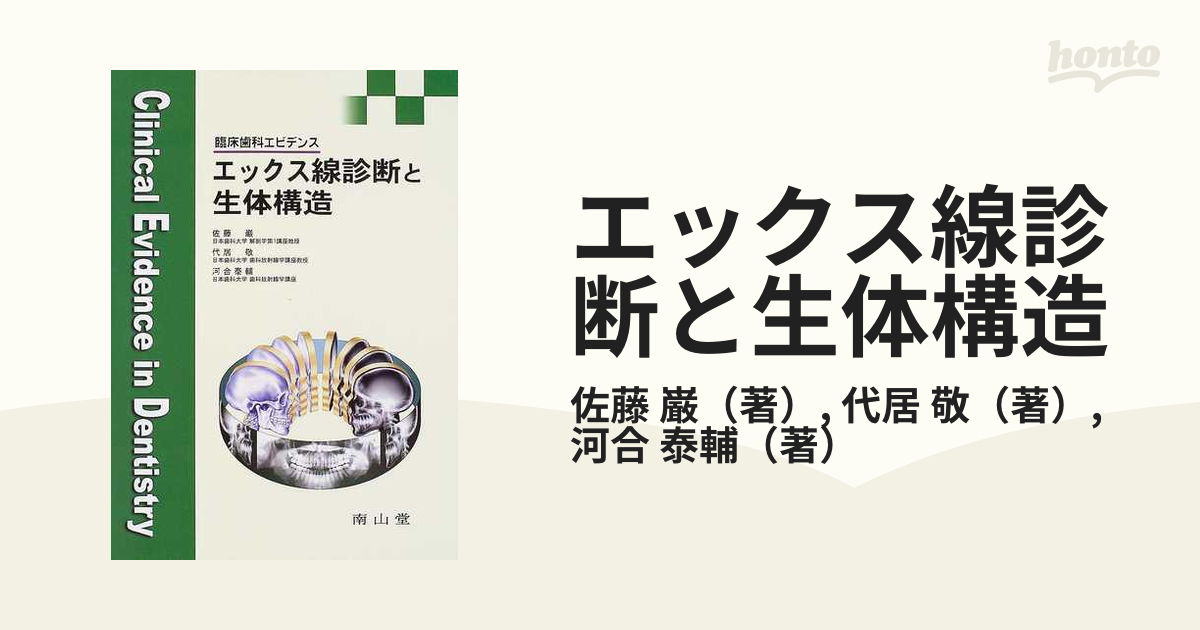 A4等級以上 エックス線診断と生体構造 : 臨床歯科エビデンス - 通販