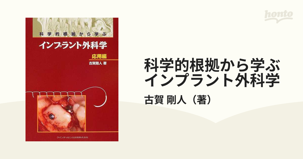 科学的根拠から学ぶインプラント外科学 応用編