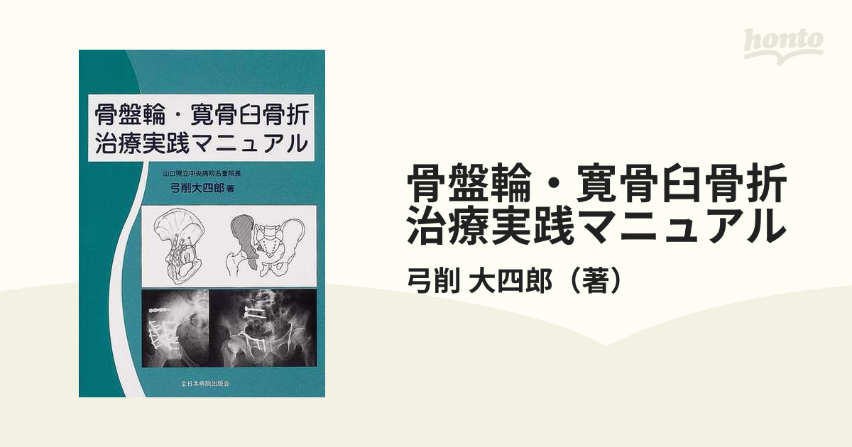 骨盤骨折 寛骨臼骨折 骨盤輪骨折の手術手技 - 本