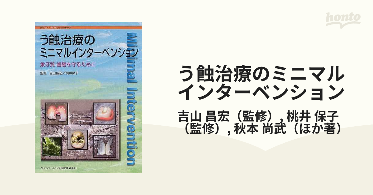 う蝕治療のミニマルインターベンション◇象牙質－歯髄を守るために