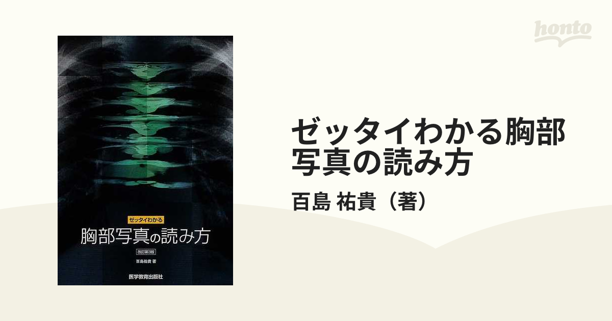 ゼッタイわかる 胸部写真の読み方 改訂第３版 - 健康