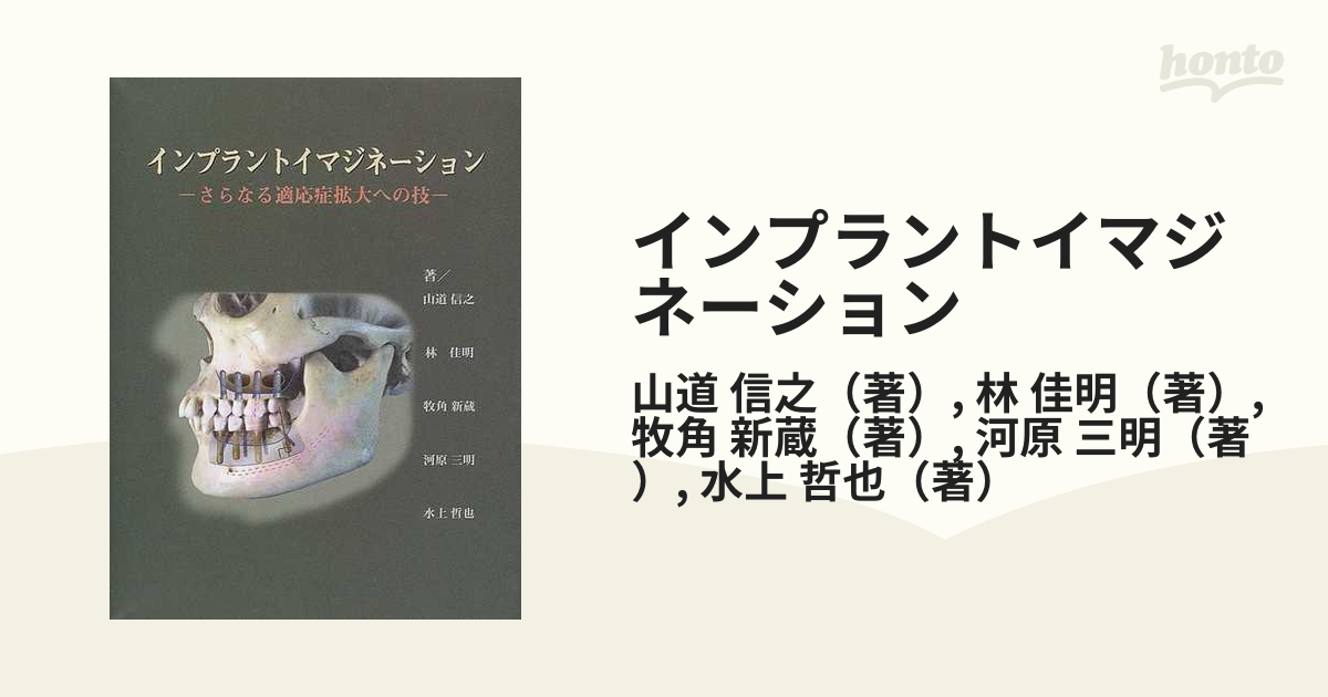 林佳明143 インプラントイマジネーション : さらなる適応症拡大