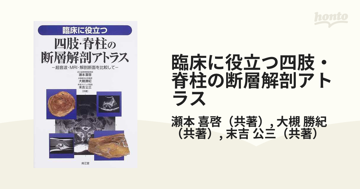 臨床に役立つ四肢・脊柱の断層解剖アトラス 超音波・ＭＲＩ・解剖断面を比較して