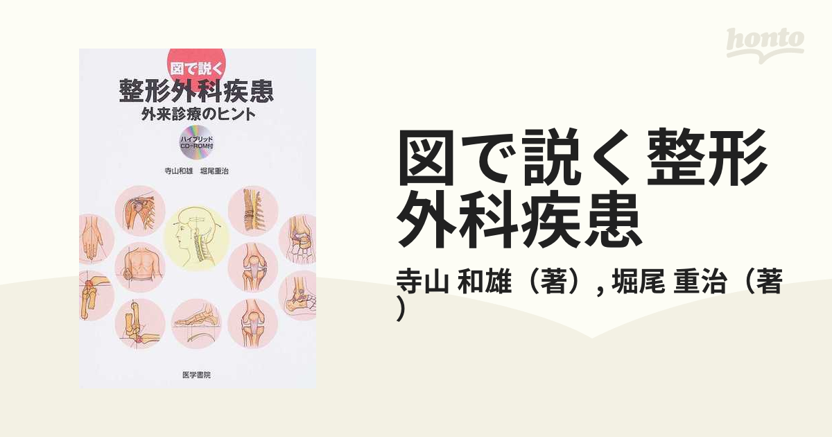 紙の本：honto本の通販ストア　図で説く整形外科疾患　重治　外来診療のヒントの通販/寺山　和雄/堀尾