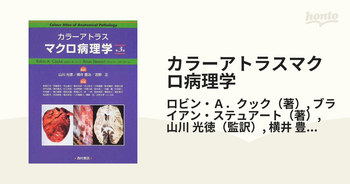 カラーアトラスマクロ病理学 第３版の通販/ロビン・Ａ．クック