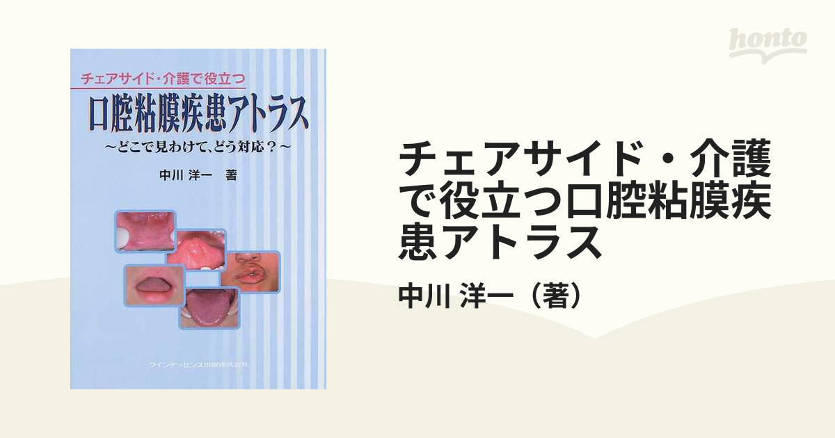 チェアサイド・介護で役立つ口腔粘膜疾患アトラス どこで見わけて,どう対応