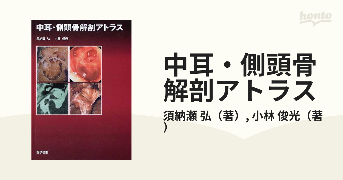 中耳・側頭骨解剖アトラスの通販/須納瀬 弘/小林 俊光 - 紙の本：honto