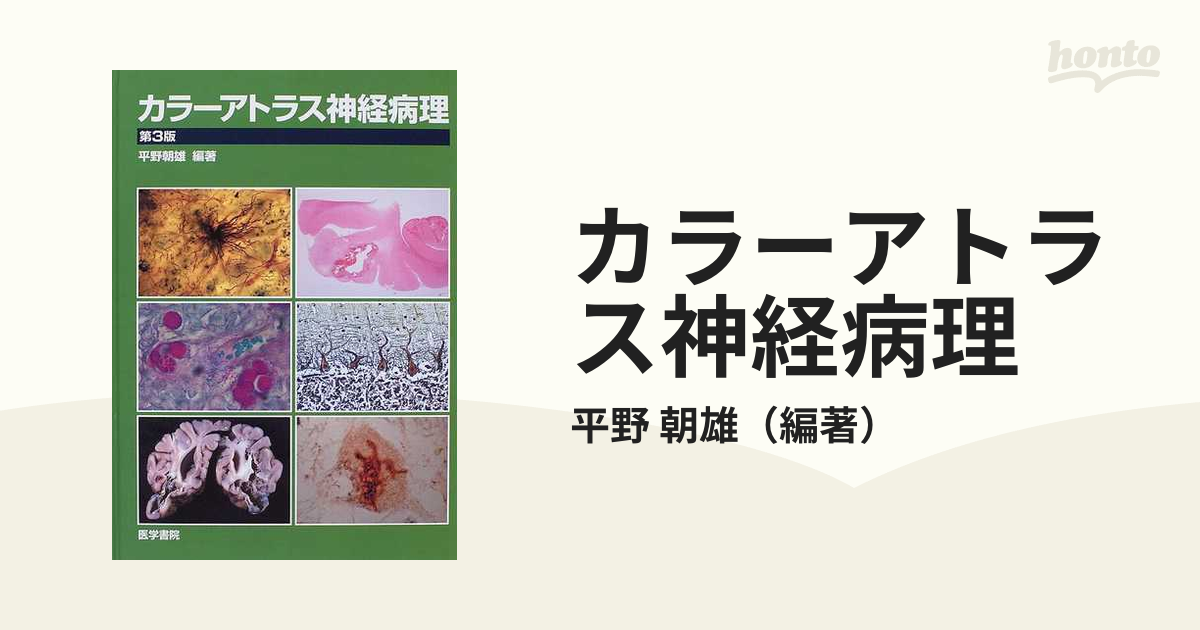 神経病理を学ぶ人のために 平野 朝雄出版社
