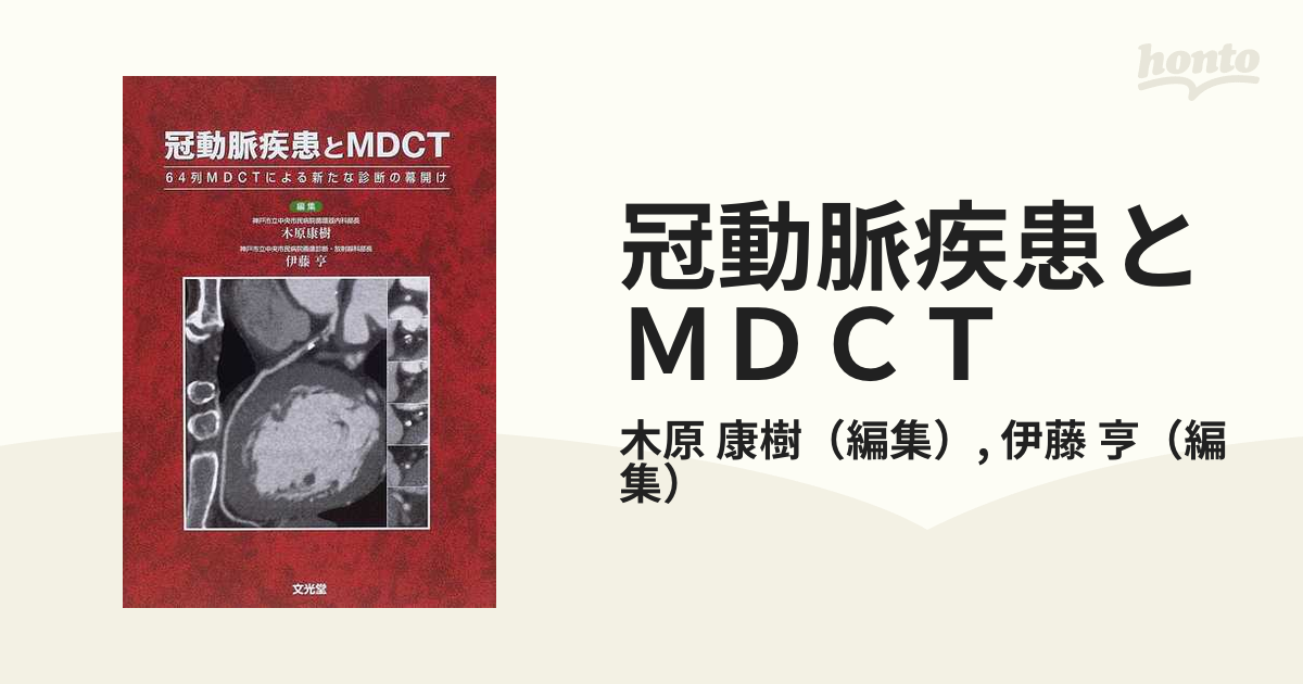 冠動脈疾患とＭＤＣＴ ６４列ＭＤＣＴによる新たな診断の幕開け／木原