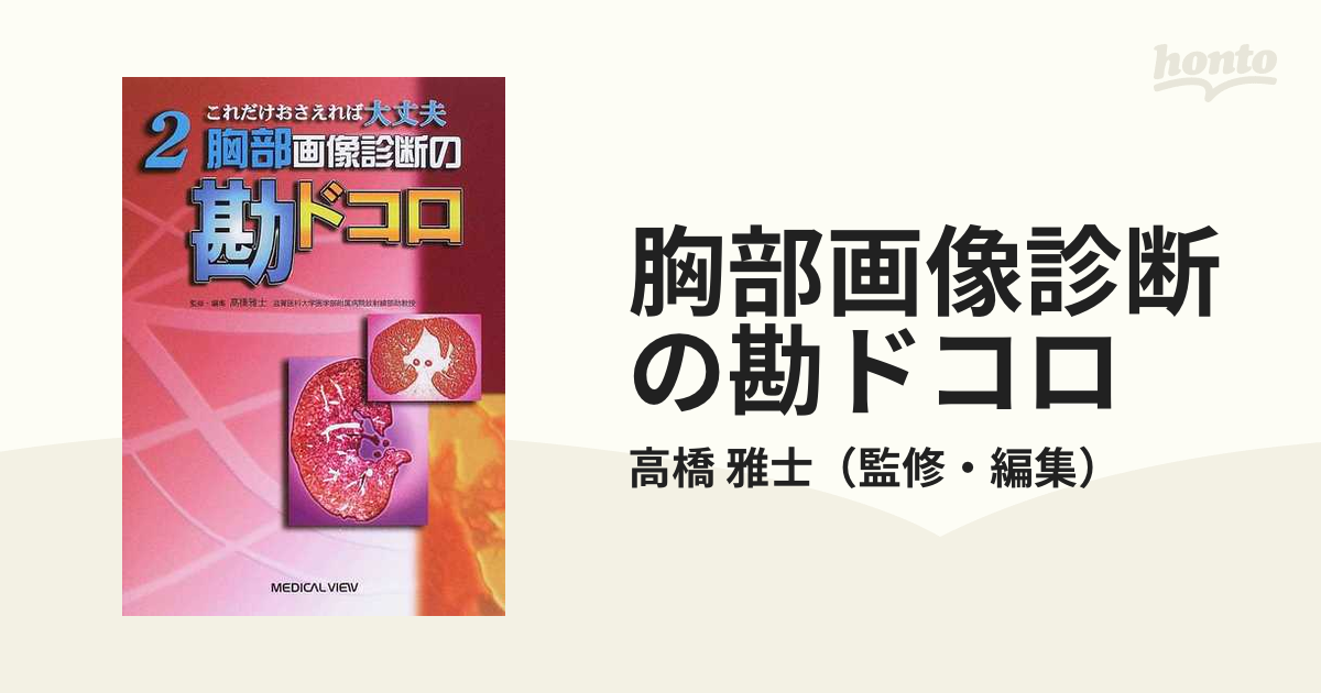 胸部画像診断の勘ドコロ これだけおさえれば大丈夫２／高橋雅士