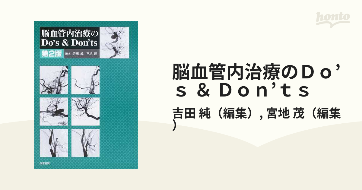 脳血管内治療のＤｏ’ｓ ＆ Ｄｏｎ’ｔｓ 第２版