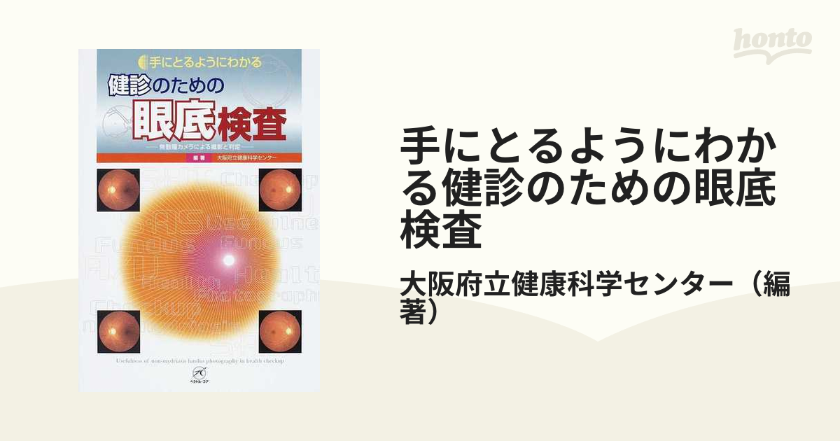 手にとるようにわかる健診のための眼底検査 : 無散瞳カメラによる撮影と判定 手にとるようにわかる健診のための眼底検査 : 無散瞳
