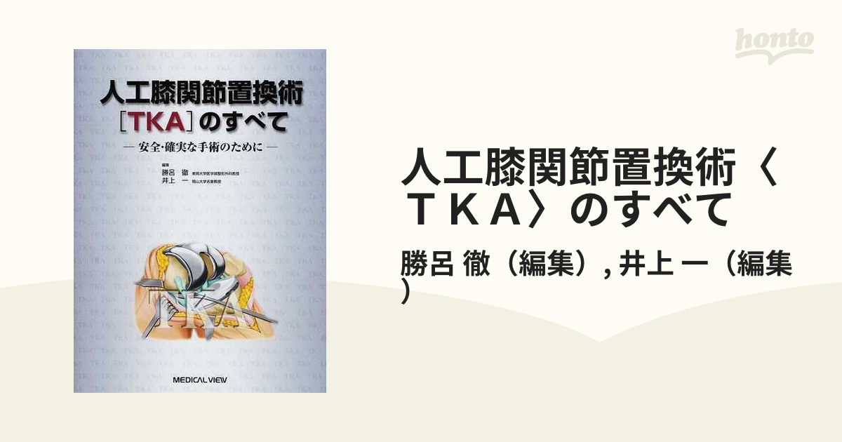 裁断済み 人工膝関節全置換術[TKA]のすべて より安全に・より確実に 