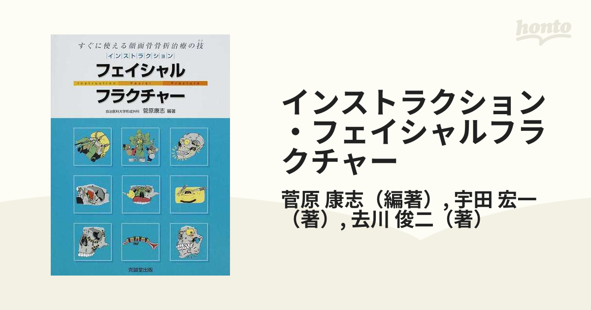 インストラクション・フェイシャルフラクチャー すぐに使える顔面骨骨折治療の技