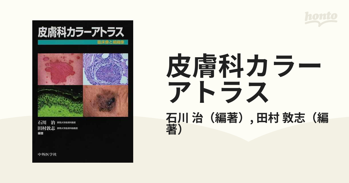 皮膚科カラーアトラス 臨床像と組織像