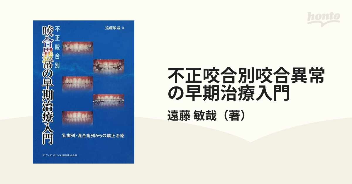 不正咬合別咬合異常の早期治療入門 乳歯列・混合歯列からの矯正治療