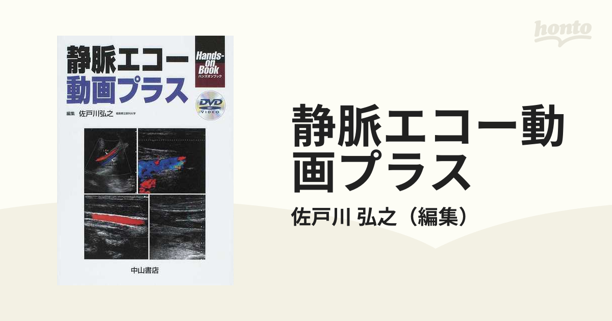 静脈エコー動画プラスの通販/佐戸川 弘之 - 紙の本：honto本の通販ストア