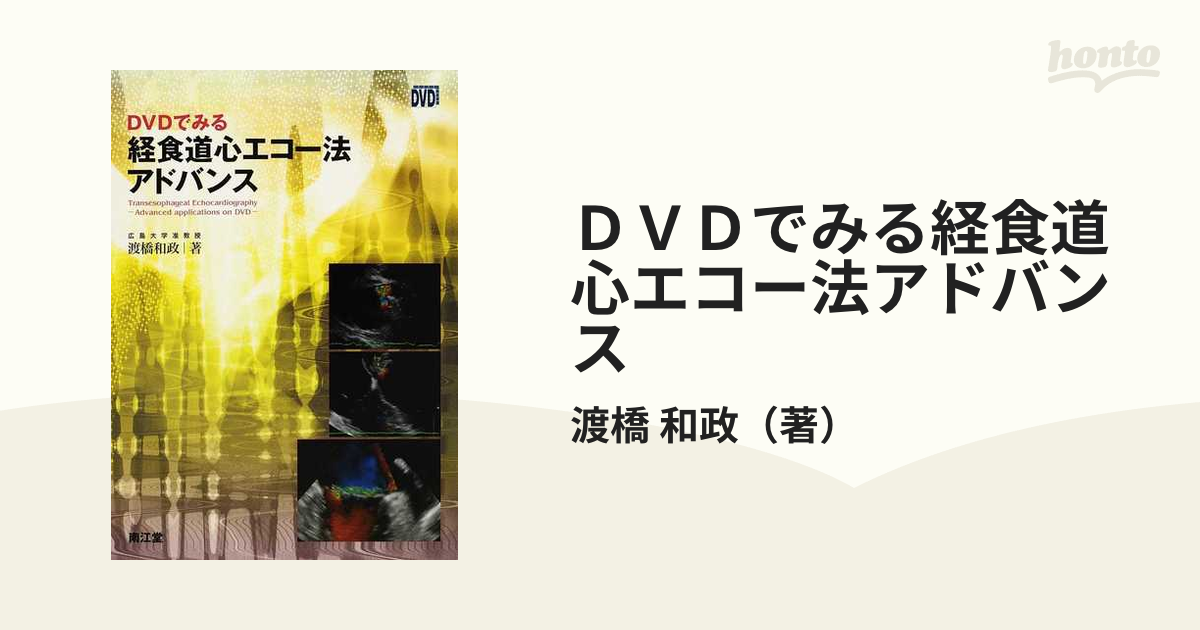 2553円 DVDでみる 経食道心エコー法アドバンス 渡橋和政 - 医学