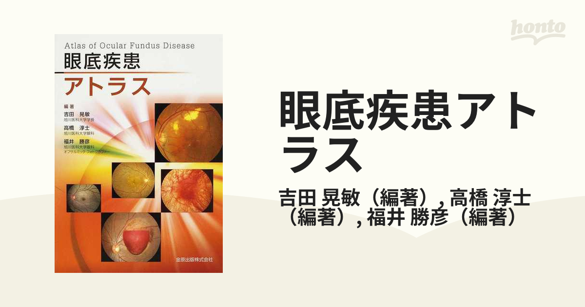 眼底疾患パーフェクトアトラス