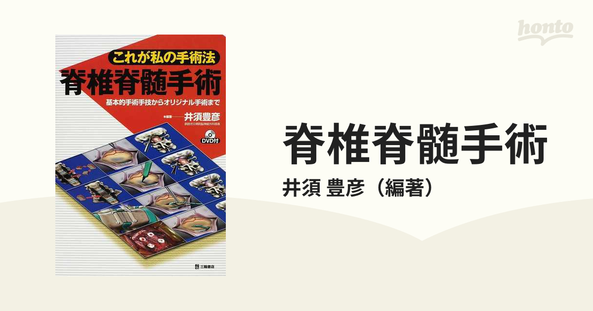 脊椎脊髄手術 これが私の手術法 基本的手術手技からオリジナル手術まで 