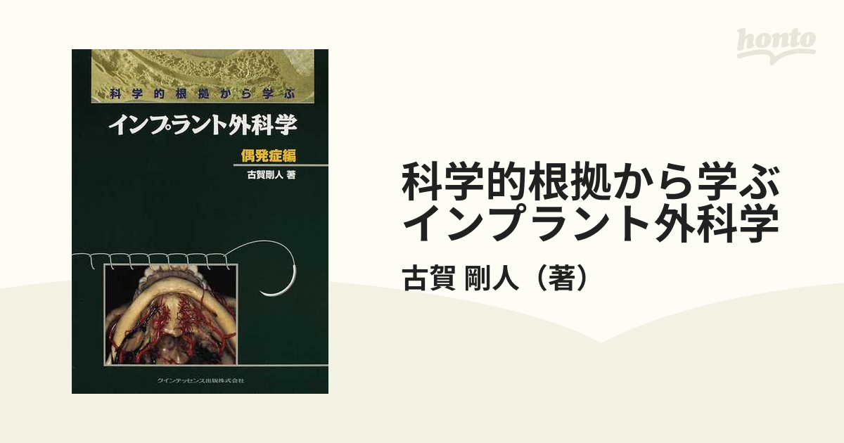 科学的根拠から学ぶインプラント外科学 偶発症編の通販/古賀 剛人 - 紙