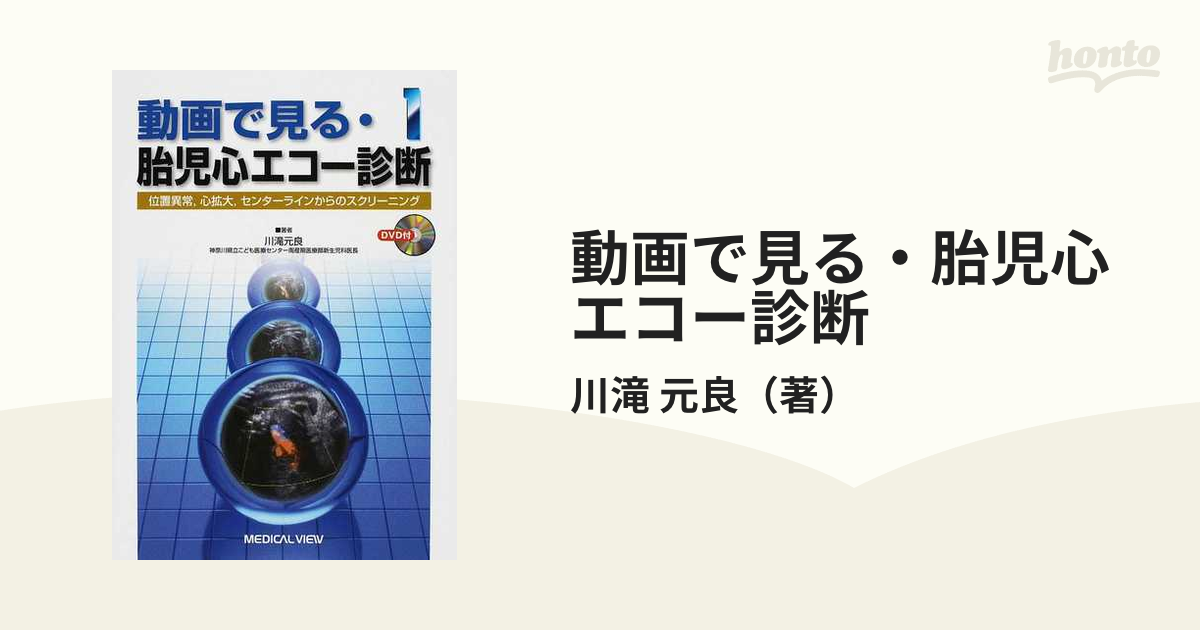 動画で見る・胎児心エコー診断 １ 位置異常，心拡大，センターライン