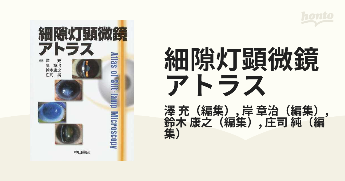 細隙灯顕微鏡アトラスの通販/澤 充/岸 章治 - 紙の本：honto本の通販ストア