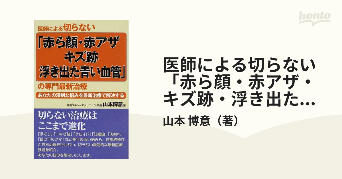 医師による切らない「赤ら顔・赤アザ・キズ跡・浮き出た青い血管」の専門最新治療 あなたの深刻な悩みを最新治療で解決する