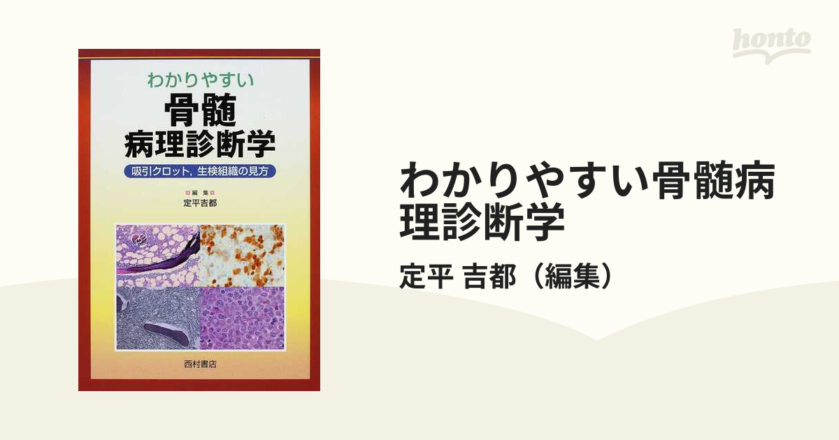 わかりやすい骨髄病理診断学 吸引クロット，生検組織の見方