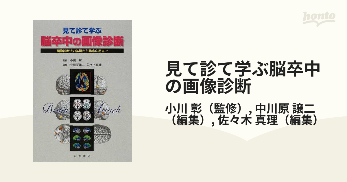 症状・経過観察に役立つ 脳卒中の画像のみかた - 健康・医学