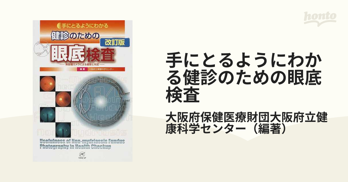 新品 手にとるようにわかる健診のための眼底検査 : 無散瞳カメラによる 